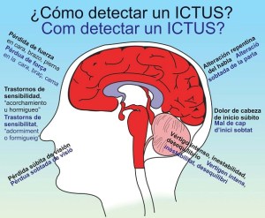 Detectar un Ictus