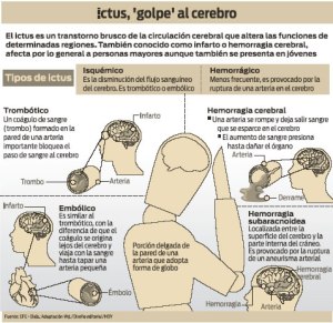 tipos-de-ictus